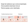 Electric Blackhead Removal Machine Adjustable Vacuum Suction Oil Control Pore