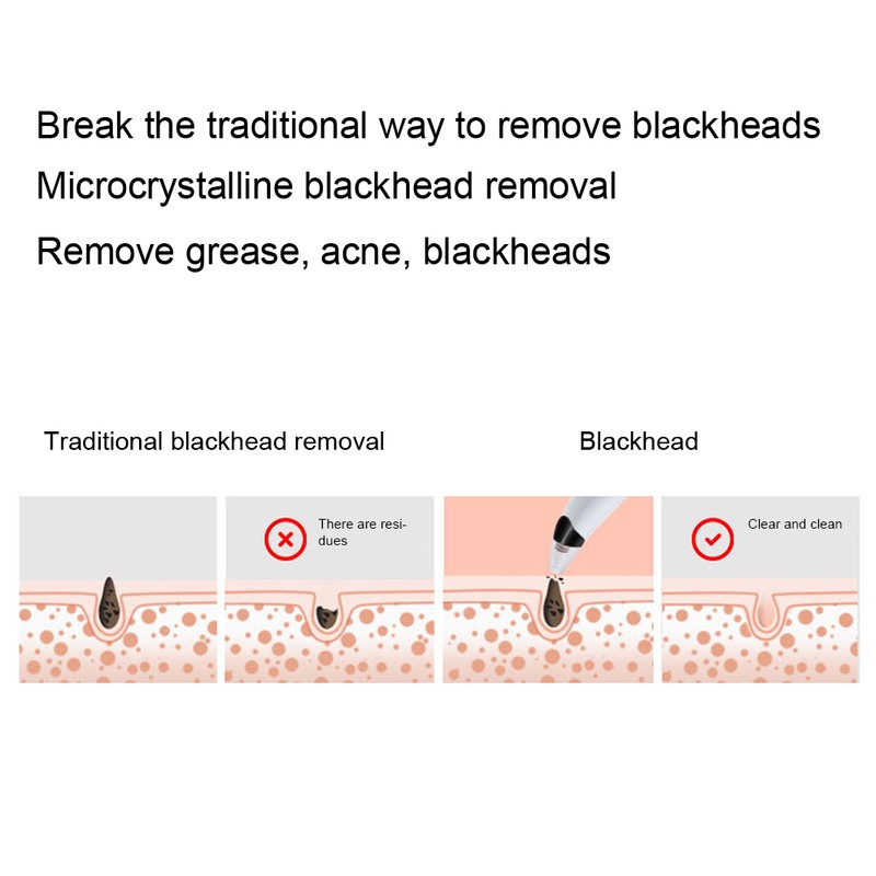Electric Blackhead Removal Machine Adjustable Vacuum Suction Oil Control Pore
