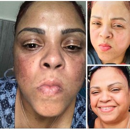 Jacvon LLC WHITE FADE CREAM: SUPER SKIN LIGHTENER TO REMOVE DARK SPOTS, SIZE 2oz.