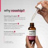 Rosehip Oil by Natural Outcome for Women - 1 oz