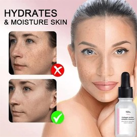 2022 New Sheep Placenta Collagen Serum,2Pcs BlemishSkin Corrector Serum,Collagen Protein Complex Essence Anti Wrinkle Serum for Face,Moisturizing Brightening Repair Serum