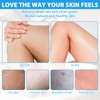 4 Stück Exfoliating Gloves Peelinghandschuh Körper Sanfte Effektives Peeling Runde