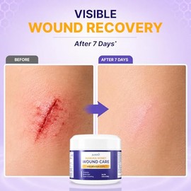 PURESKIN Manuka Honey Wound Care: Manuka Honey Wound Gel for Cuts, Scrapes & Burns - Natural-Inspired Moisturizing Formula - 2.82 oz (Pack of 1)