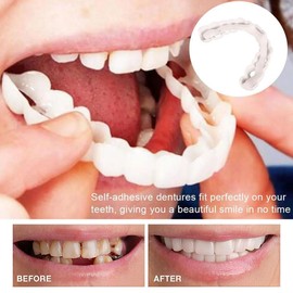 Zähne zum Aufstecken, 2 Paar Prothesen Gefälschte Zähne, Veneers Zahnersatz Oben und Unten, Aufhellung Zahnersatz, Lächeln Instant Veneers Gebiss Zähne