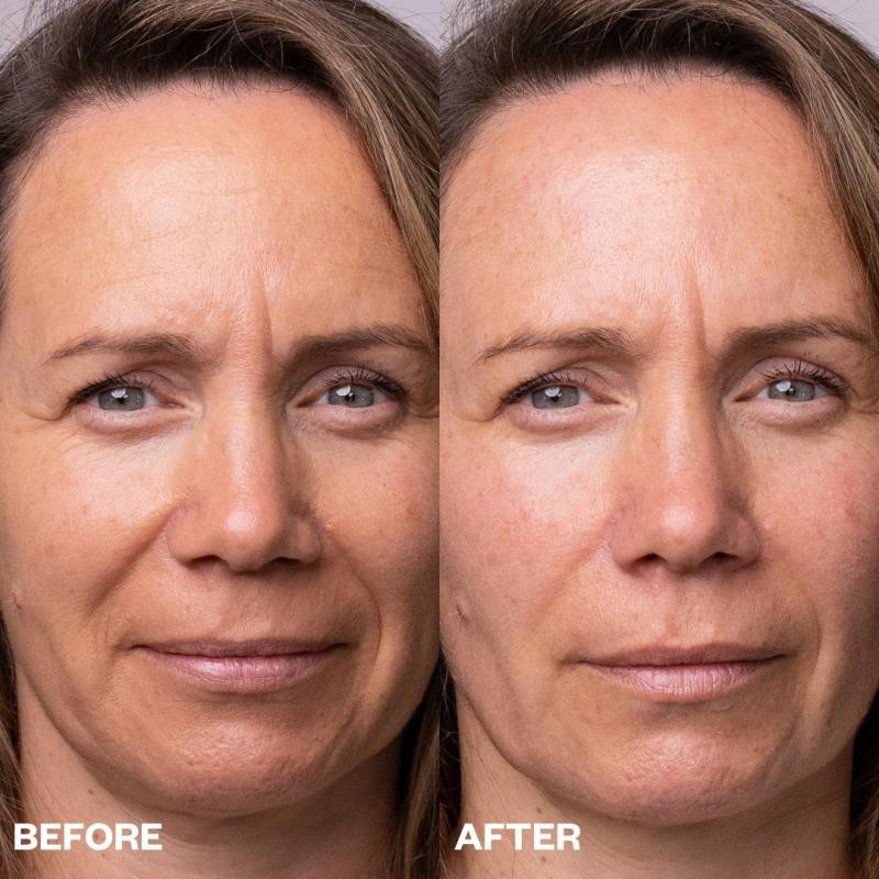 Wrinkles Schminkles Face Polishing Peel Pads - 5 Pack