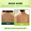 pure.tiful 2% Salicylic Acid (BHA) Serum for Acne & Blackheads