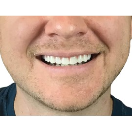 Instant Smile Comfort Fit Flex Natural Shade