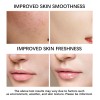 Crema Facial, Loción Hidratante Refrescante Y Cuidado, 100 G