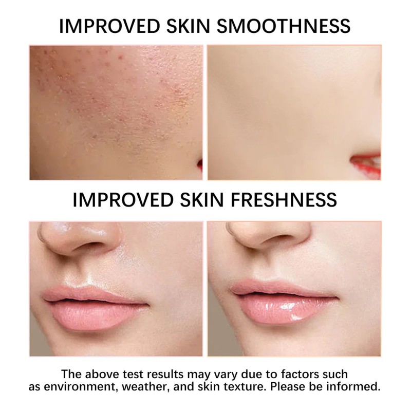 Crema Facial, Loción Hidratante Refrescante Y Cuidado, 100 G