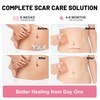 Silicone Scar Tape for Surgical Scars, Silicone Scar Sheets, C