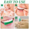Aligner Chewies for Aligners - 10 Pcs Mint-Scented Aligner Accessories