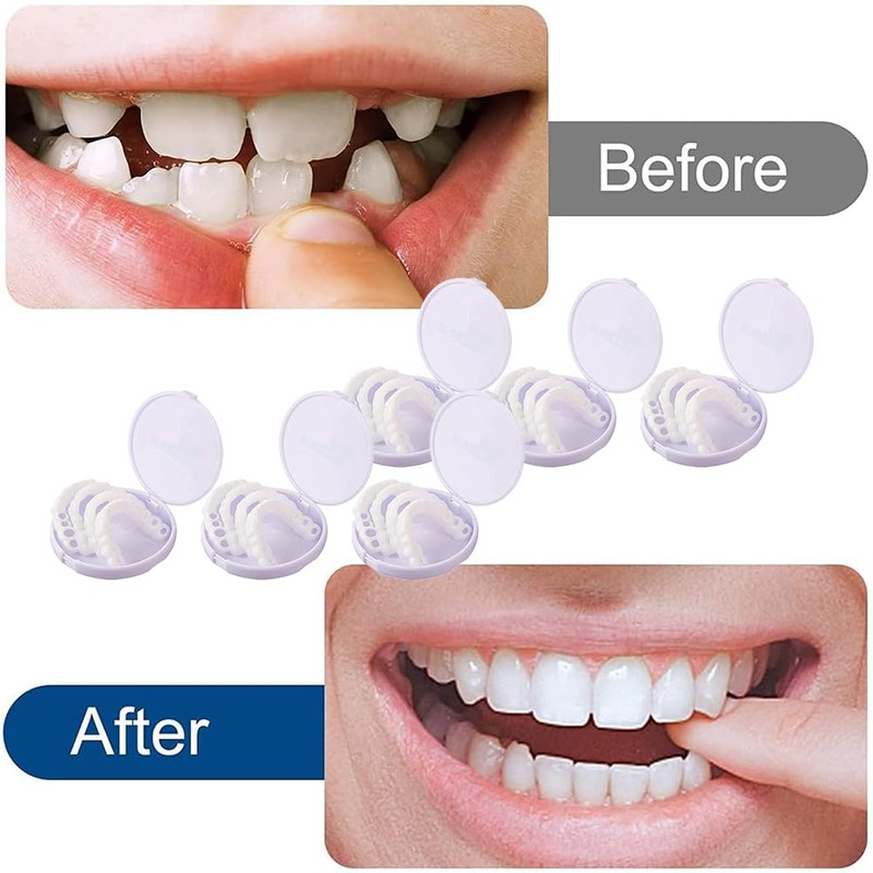 Fake Teeth 6 Pairs False Artificial Temporary Teeth Braces Smile