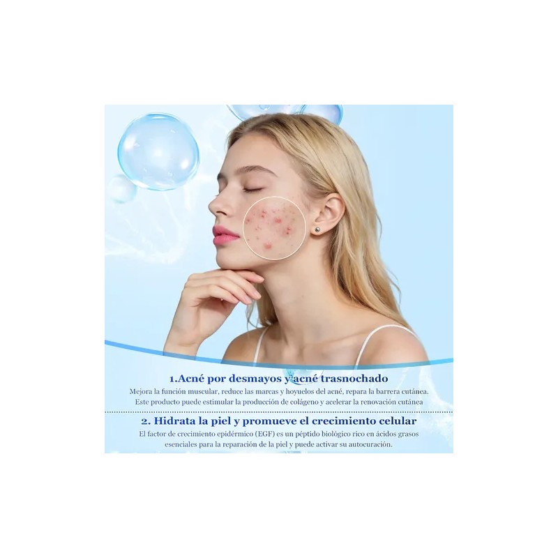 Acne Buster Loción Secante Con Ácido Salicílico 10ml