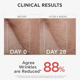 APIVITA Bee Tech Sérum C15 Propolis Correct – Sérum Antiedad con 15% Vitamina C + 1% Vitamina E + Propóleo Patentado AoX-CR - Luminosidad, Antioxidant