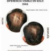 Sérum capilar Masofta para el crecimiento del cabello. Promueve el