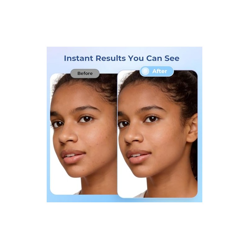 Ultra-Thin Hydrocolloid Pimple Patches - 504 Count