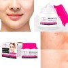 Crema Facial Aclaradora Aichun Remueve Manchas Oscuras