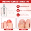YEQOIZ Ingrown Toenail Treatment Tool Kit, Ingrown Toenail Removal Kit
