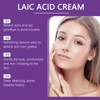 15% Acid Spot Cream with Face Cleanser,Acne Treatment Cream Set,Fast