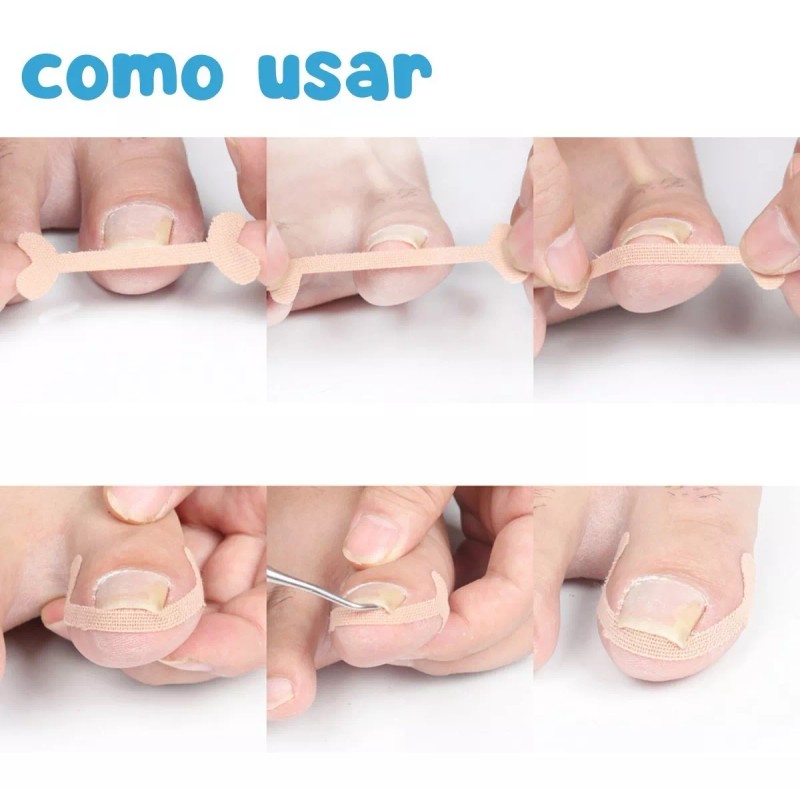 Universo en Linea Kit Corrección Uñas Encarnadas Pie Herramienta Pedicura
