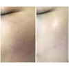 sMTS Crystal Mask Pack Kit