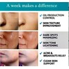 Derma peel Glycolic Acid 20% Resurfacing Pads for face,chest ,back