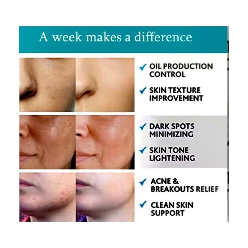 Derma peel Glycolic Acid 20% Resurfacing Pads for face,chest ,back