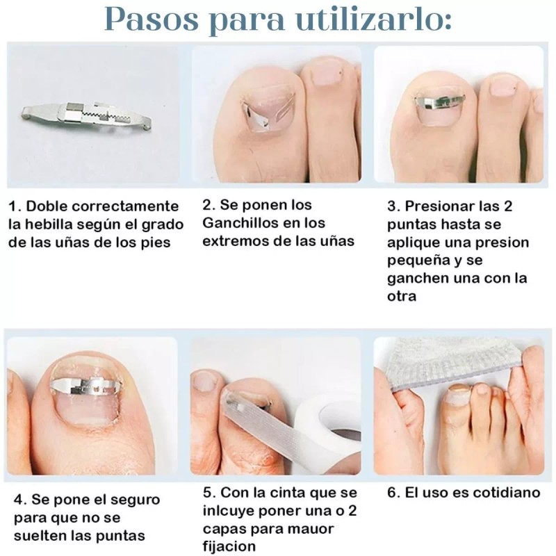 Universo en Linea Herramientas Corrección De Uñas Encarnadas Alivia Dolor