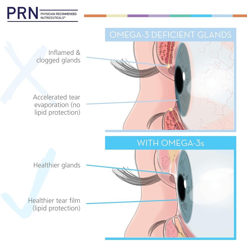 Omega 3 Gummy Chewables - 90 Gel Chews, 30-Day Supply,