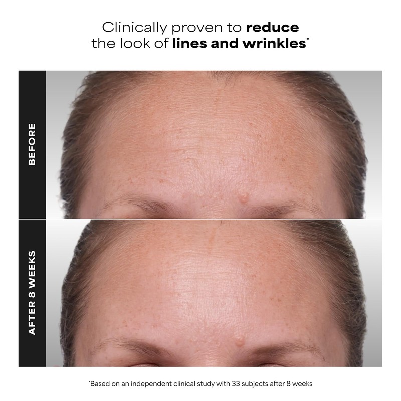 Paula's Choice CLINICAL 1% Retinol Face Treatment with Peptides, Vitamin