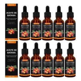 10pc Weud Battana Aceite Capilar Nutrir Para Cuero Cabelludo