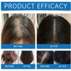 Scalp Cooling Hair Ampoule,Hair Loss Serum,Ha-Ir Density Serum,Scalp Protector,Sca-Lp Se-Rum