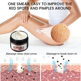 140G Strawberry Legs Treatment, Keratosis Pilaris Cream，Moisturizing Strawberry Skin Treatment for Chicken Skin, Exfoliating Body Cream,Skin Smooth Radiant Skin Care,For All Skin Types