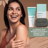 Jabón de Alquitrán para Psoriasis y Eccema, Barra Medicada 2.50