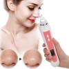 Electric Facial Blackhead Cleansing Vacuum Suction Machine with 20X 5MP