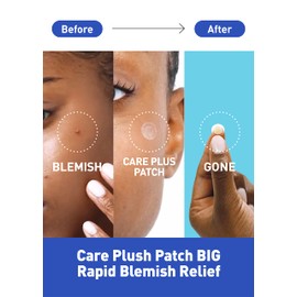 OLIVE YOUNG Care Plus Spot Patch Big (81 Count) | Hydrocolloid Patch, Spot Stickers for Acne Pimple and Zits | OLIVE YOUNG