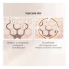 Eliminador De Oscuridad Para Hiperpigmentación Facial, Melas