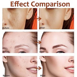 Bluemega Reducir los poros Suero Minimizador de Poros, Suero Minimizador de Poros para la Piel de la Cara, Reduce los Poros, Alivia la Sequedad,...   