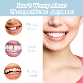 False Teeth Veneers Top and Bottom,Veneers Teeth,Clip on Veneers Top and Bottom,Forged Tooth Veneers Top and Bottom,Veneers Clip pn Top and Bottom Temporary Teeth for Confident Smile