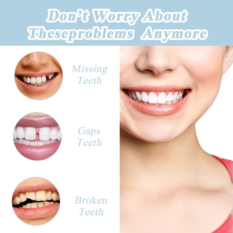 False Teeth Veneers Top and Bottom,Veneers Teeth,Clip on Veneers Top