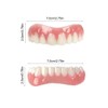 Upper and Lower Veneer, Dentures for Women and Men, Fake