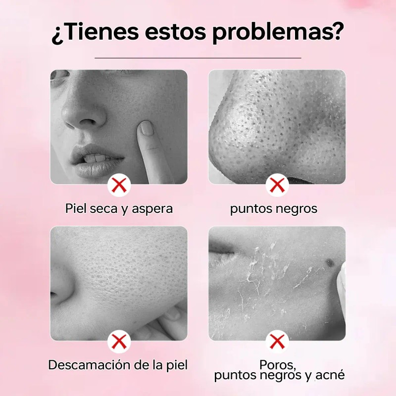 Gel Exfoliante Blanqueador Quarxery Para Eliminar Puntos Neg