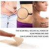 3 Meters Silicone Scar Stickers to Reduce Itching and Redness