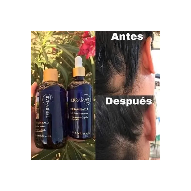 Pack 3 Set Anticaida Shampoo + Suero Crecimiento + Gel