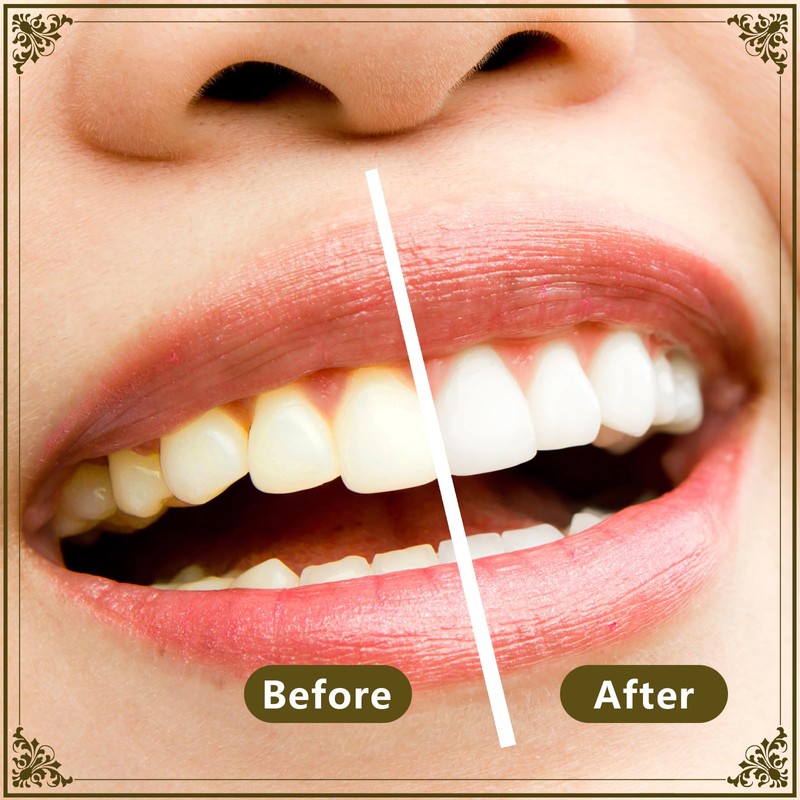 Miswak Sticks for Teeth Pack of 12 - Vacuum Sealed