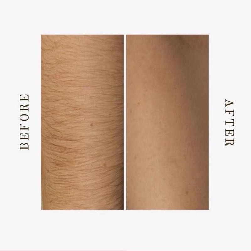 100% Pure Cyperus Rotundus Oil for Hair Removal