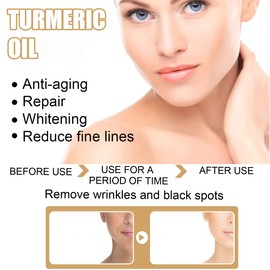 Turmeric Dark Spot Corrector Serum, Ksndurn Turmeric Repair Face Serum - kin Care Moisturizing Repair Serum (2 PCS)