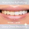 Professionelles Zahnbleaching Set ohne Peroxid – Zahnaufhellung mit LED-Licht &