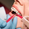 30 bandas elásticas dentales multicolor para tirantes, de plástico, desechables,