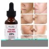. 30 Ml De Tca Aid Exfoliante Para La Piel,